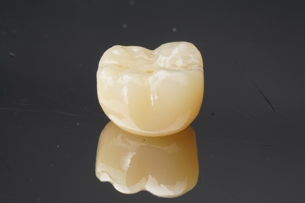 Metal Crowns Vs  Porcelain Dental Crowns